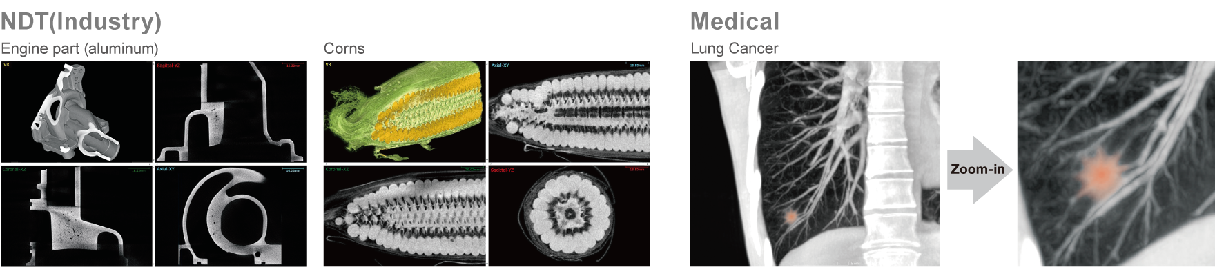 CT image