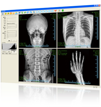 Industrial X-Ray Computed Tomography System NAOMi-CT