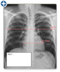 Annotation / Measurement