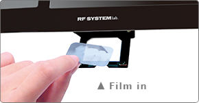 Features -X-Ray Film Scanner-