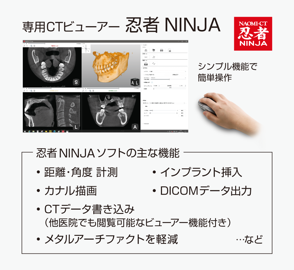 NINJA CT by 株式会社アールエフ